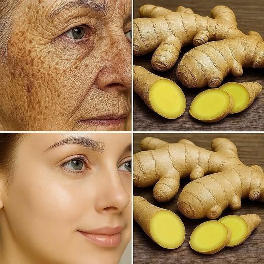 Ginger: The natural secret to youthful, glowing skin 